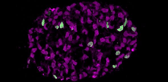 Embryoid at start of appearance of SOX17 positive cells (green cells), which depict birth of human germ cell lineage Credit: Walfred Tang (University of Cambridge)