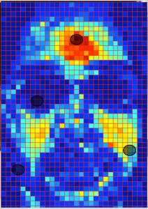 Doctors can monitor their patients’ vital signs through video by analyzing subtle changes in skin color. New software by Rice University engineers improves the technique by keying on regions of the face to help compensate for different skin tones, changes in lighting and movement. Credit: Mayank Kumar/Rice University