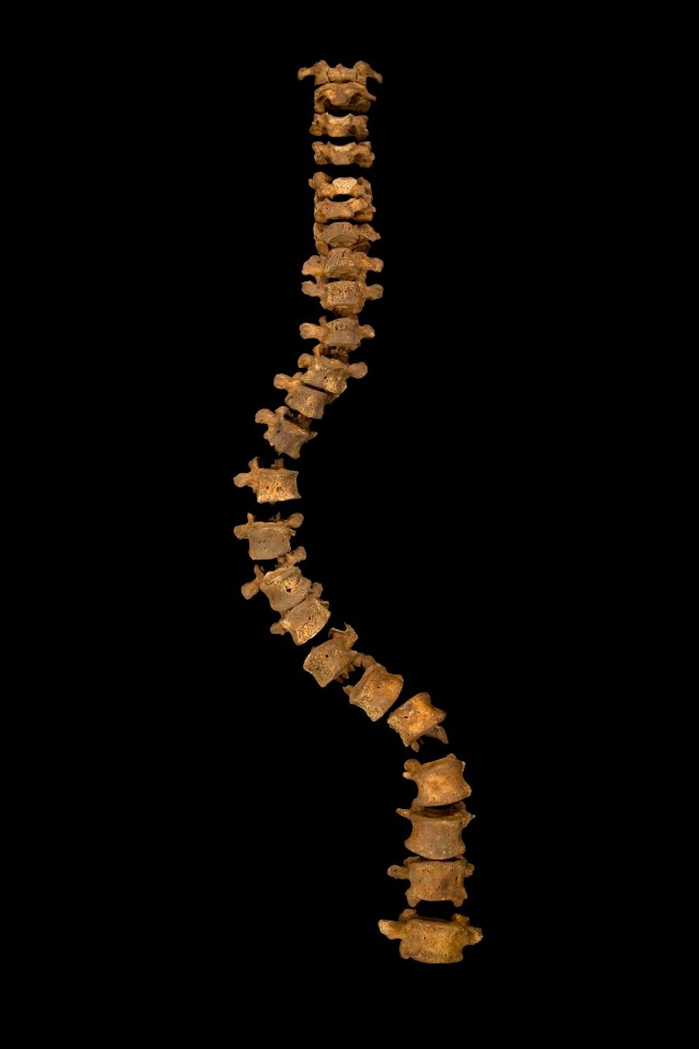 The complete spine of Richard III. The width of the curve is correct, but the gaps between vertebrae have been increased so that they do not touch each other and get damaged. This makes this spine look longer then it would have been in life. © University of Leicester
