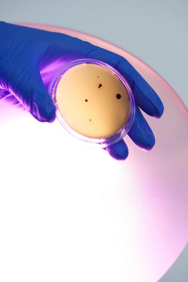 This is a microbial contamination on a contact agar plate with a 405nm light source in the background. Credit: University of Strathclyde