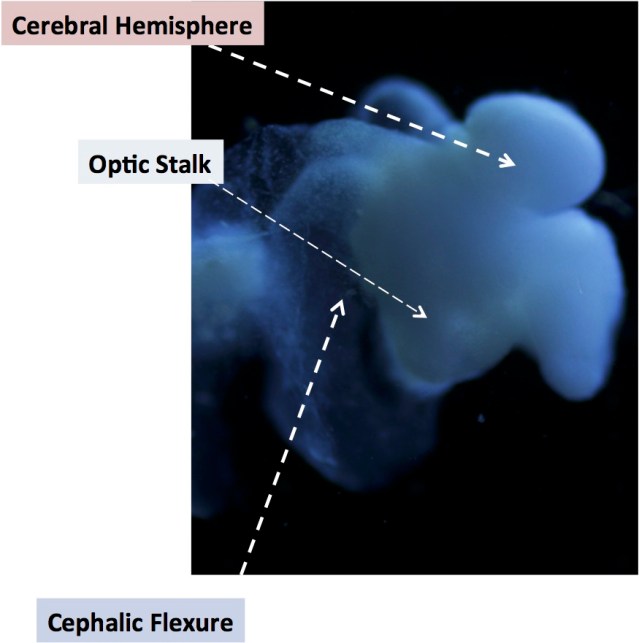 This image of the lab-grown brain is labeled to show identifiable structures: the cerebral hemisphere, the optic stalk and the cephalic flexure, a bend in the mid-brain region, all characteristic of the human fetal brain. Photo courtesy of The Ohio State University
