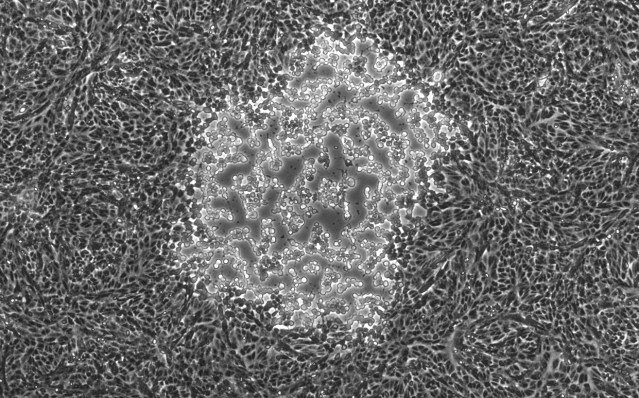 Szpara_1-reconstruction_herpes_simplex_virus_capsid_from_electron_microscopy_data_4-2016